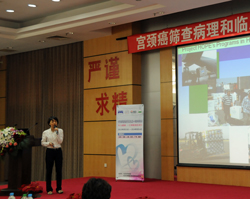Cervical Cancer Prevention Program China