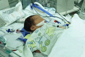 baby heart patient at Shanghai Children's Medical Center in China