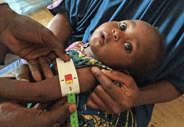 Imminent health crisis as famine threatens Nigeria