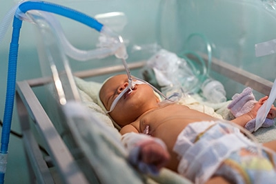 Baby lies in an incubator, hooked up to oxygen.