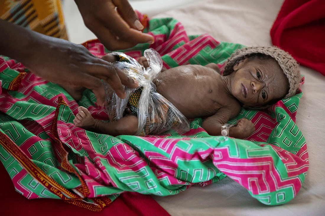 Premature small baby receiving medical care in Sierra Leone