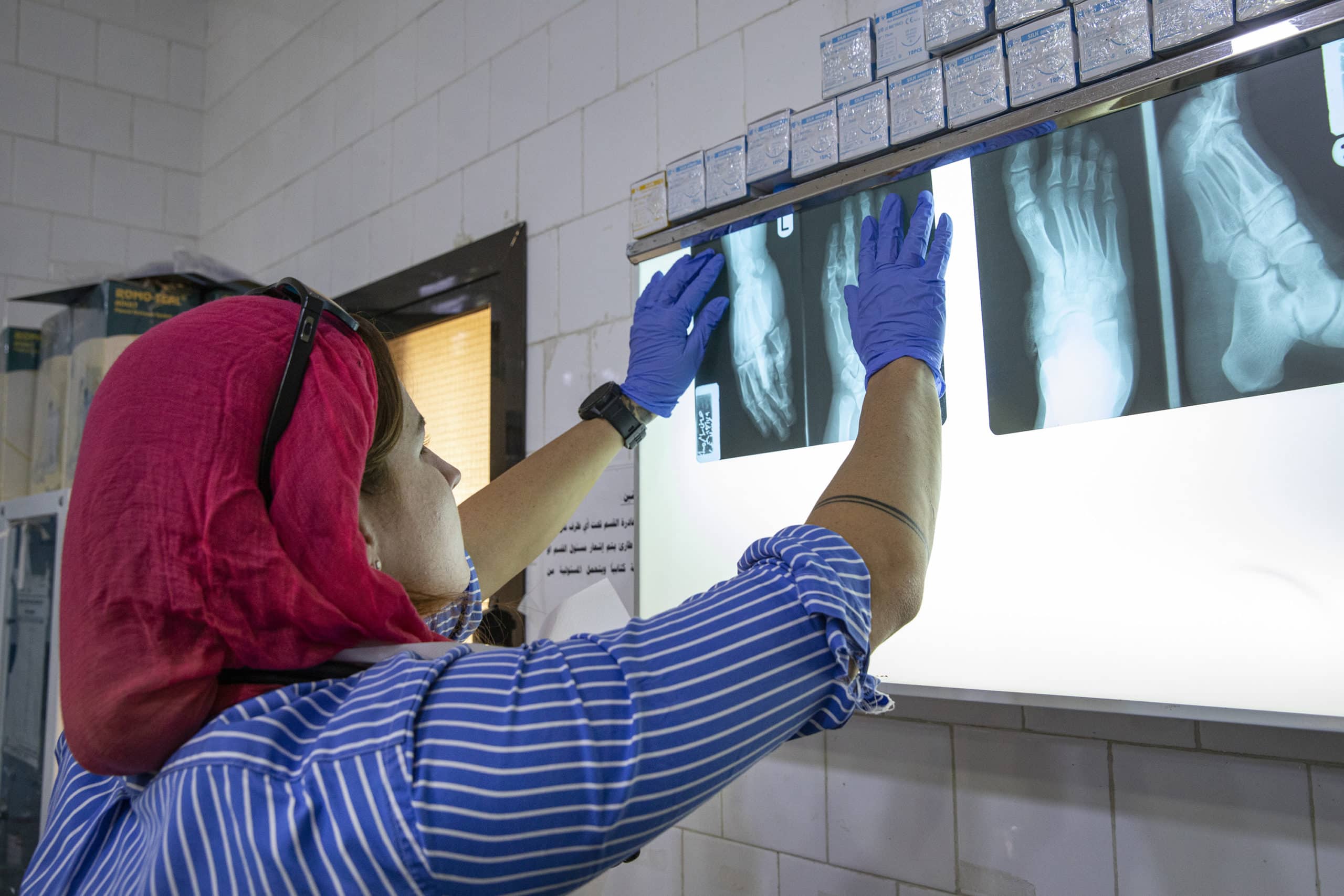 MedGlobal doctor examining an X-ray.